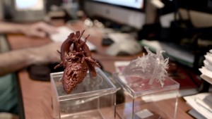 Le modèle 3D imprimée du cœur de Mia a été créé avec une imprimante 3D Stratasys, afin d’améliorer la phase de planification, de réduire les complications et de diminuer la durée de l’opération pour l'équipe chirurgicale